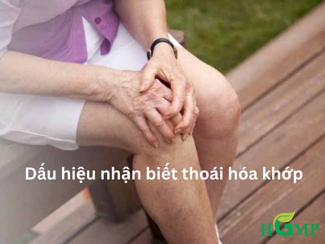 Dấu hiệu nhận biết thoái hóa khớp gối