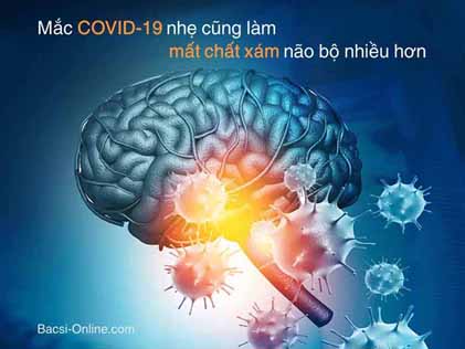 Mắc COVID-19 nhẹ cũng làm mất chất xám não bộ nhiều hơn