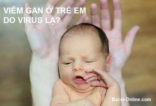 Viêm gan ở trẻ em do Virus lạ?