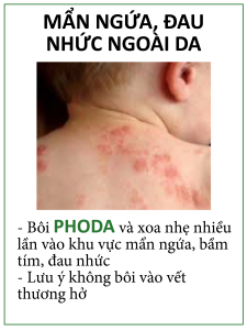 PHODA Skincare - Trị các vùng mề đay, mẩn ngứa ngoài da