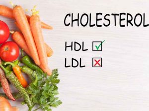 Cholesterol