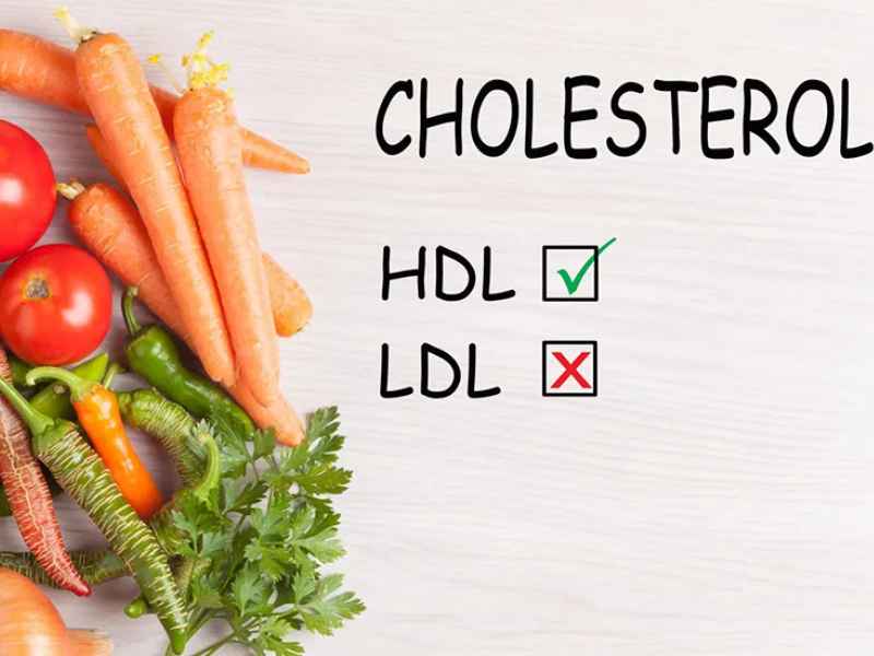 Cholesterol