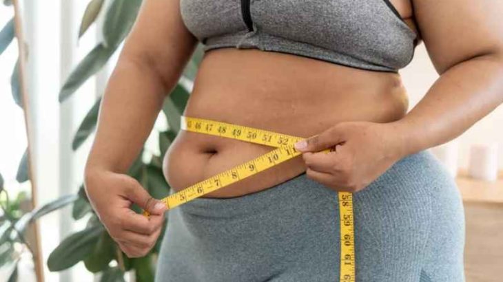 Béo PCOS