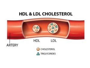 HDL LDL