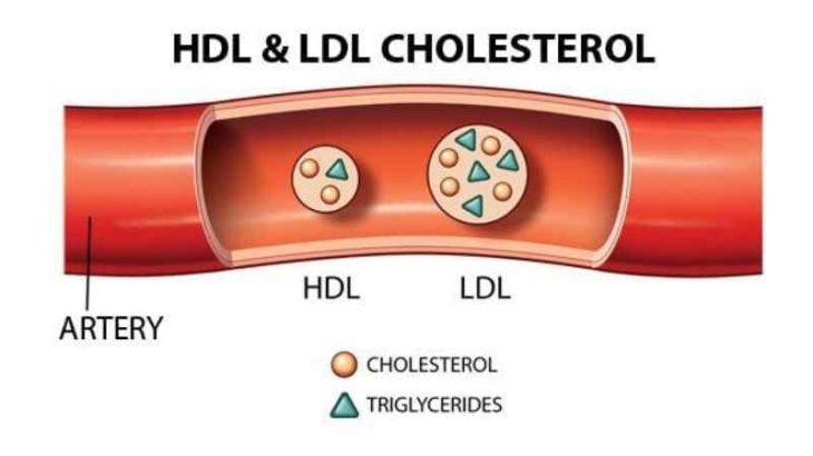 HDL LDL