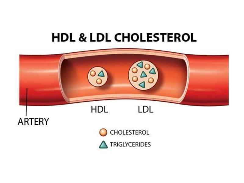 HDL LDL