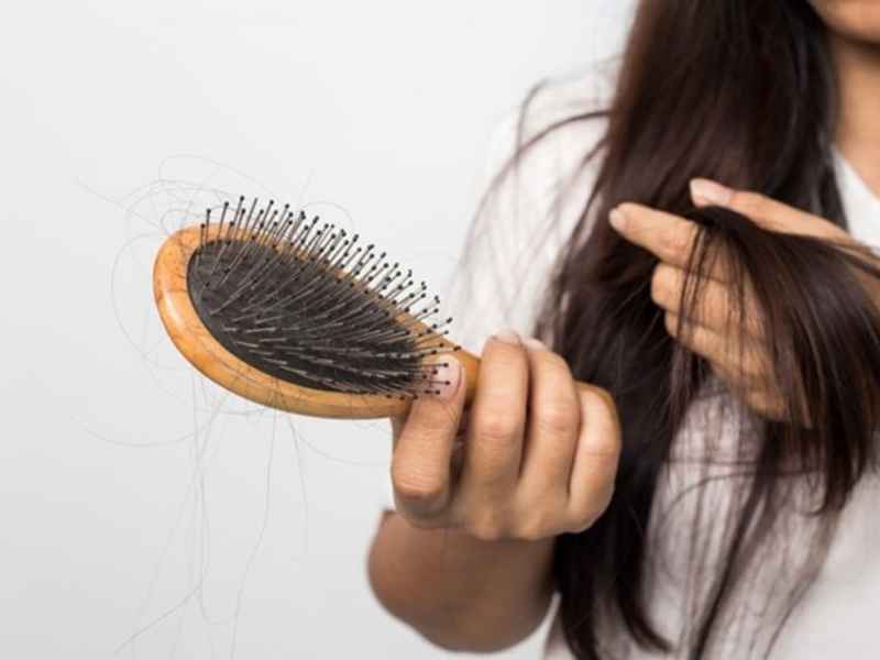 rụng tóc
